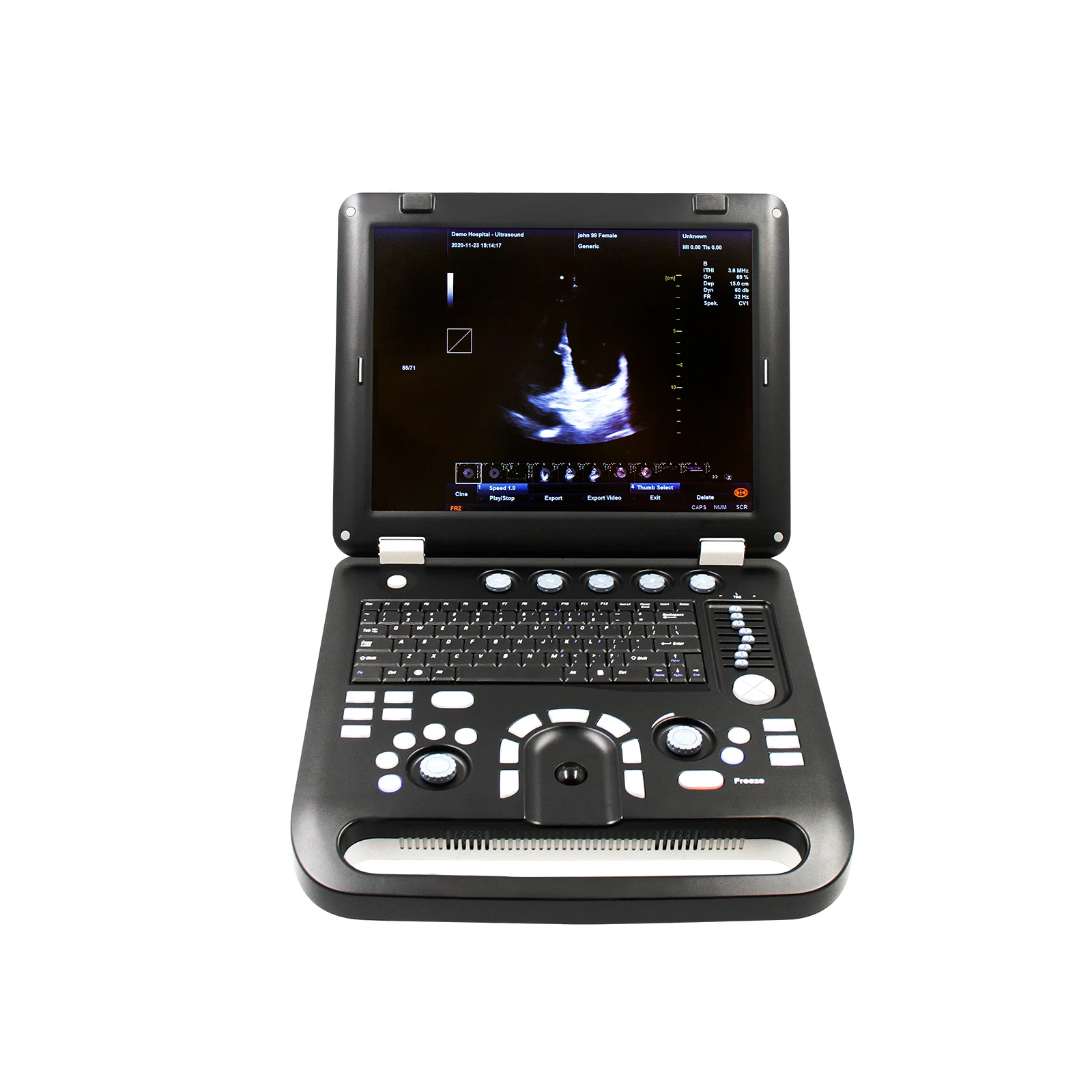 Portable Color Doppler CONTEC CMS1700A CMS1700B CMS1700C Ultrasound Scanner Machine+ convex Probe 2021 newest