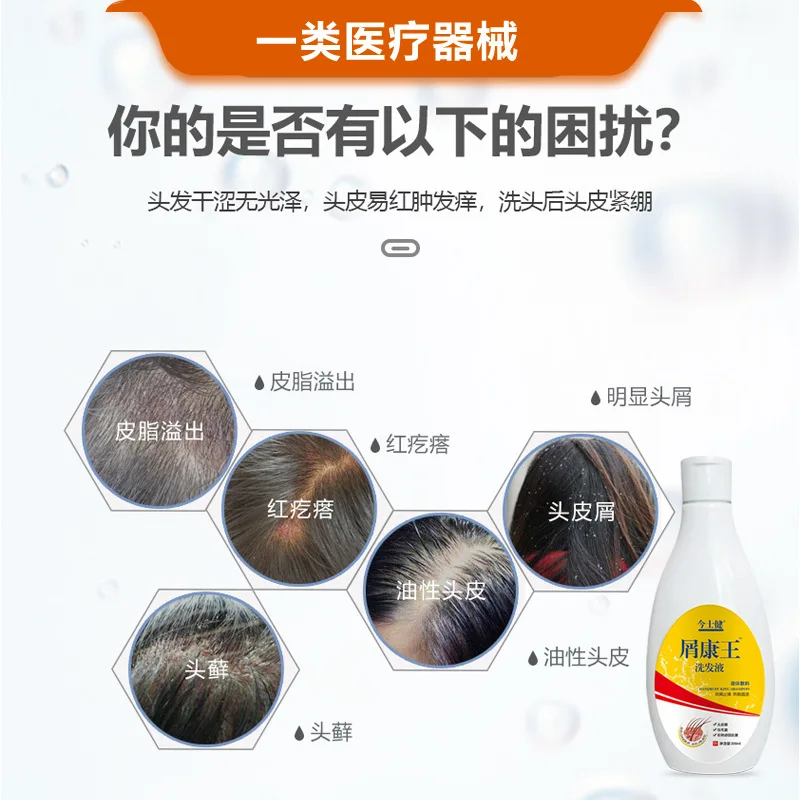 Jinshijian dandruff Kangwang shampoo, anti-dandruff, anti-shedding, soft, oily, and scalp