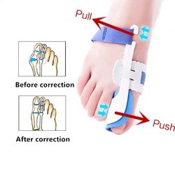 Mathiateur d'hallux valgus pour oignons et orteils, doigt, 2 pièces