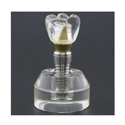 Dental Implant Model Demonstration Teeth Study Teach Model Clear M2020