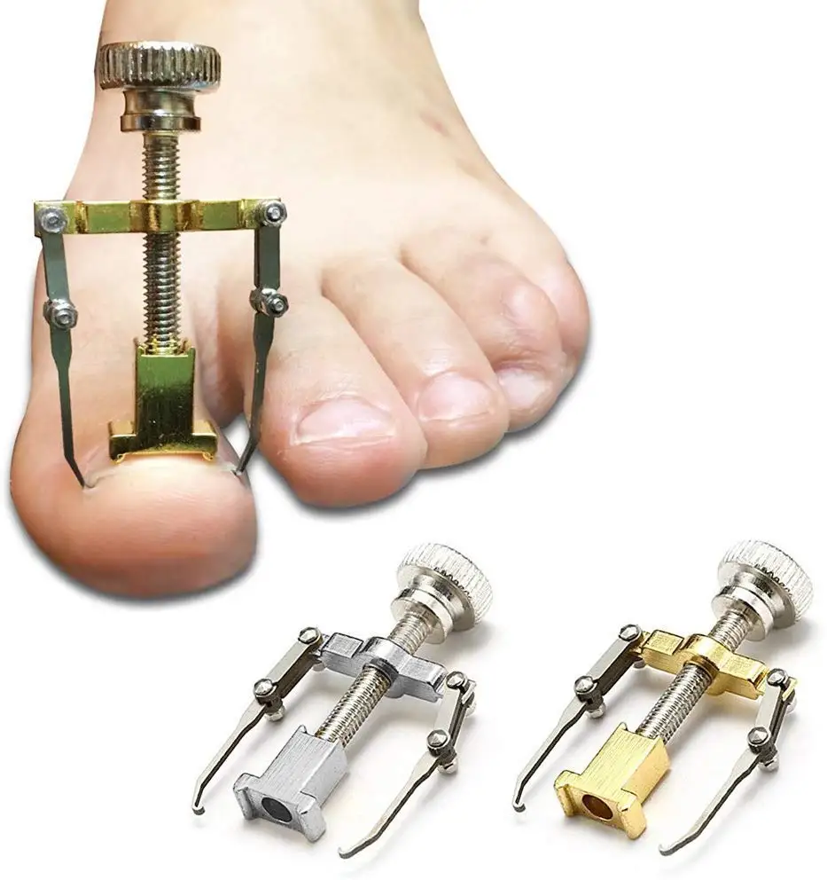 Medical Ingrown Toenail Correction Brace Kit  Professional Toe Nail Care Pedicure Manicure Clipper Fixer Recover Corrector Tool