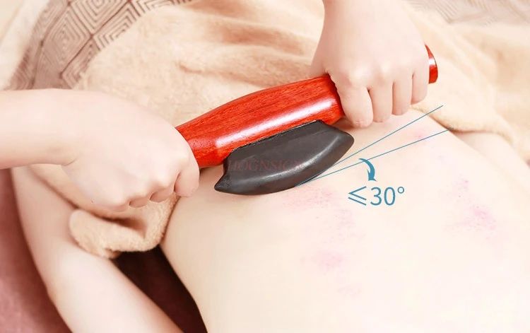 moxibustion massage  Meteorite scraping squeegee scraping plate non-electric heat scraping instrument back dredge