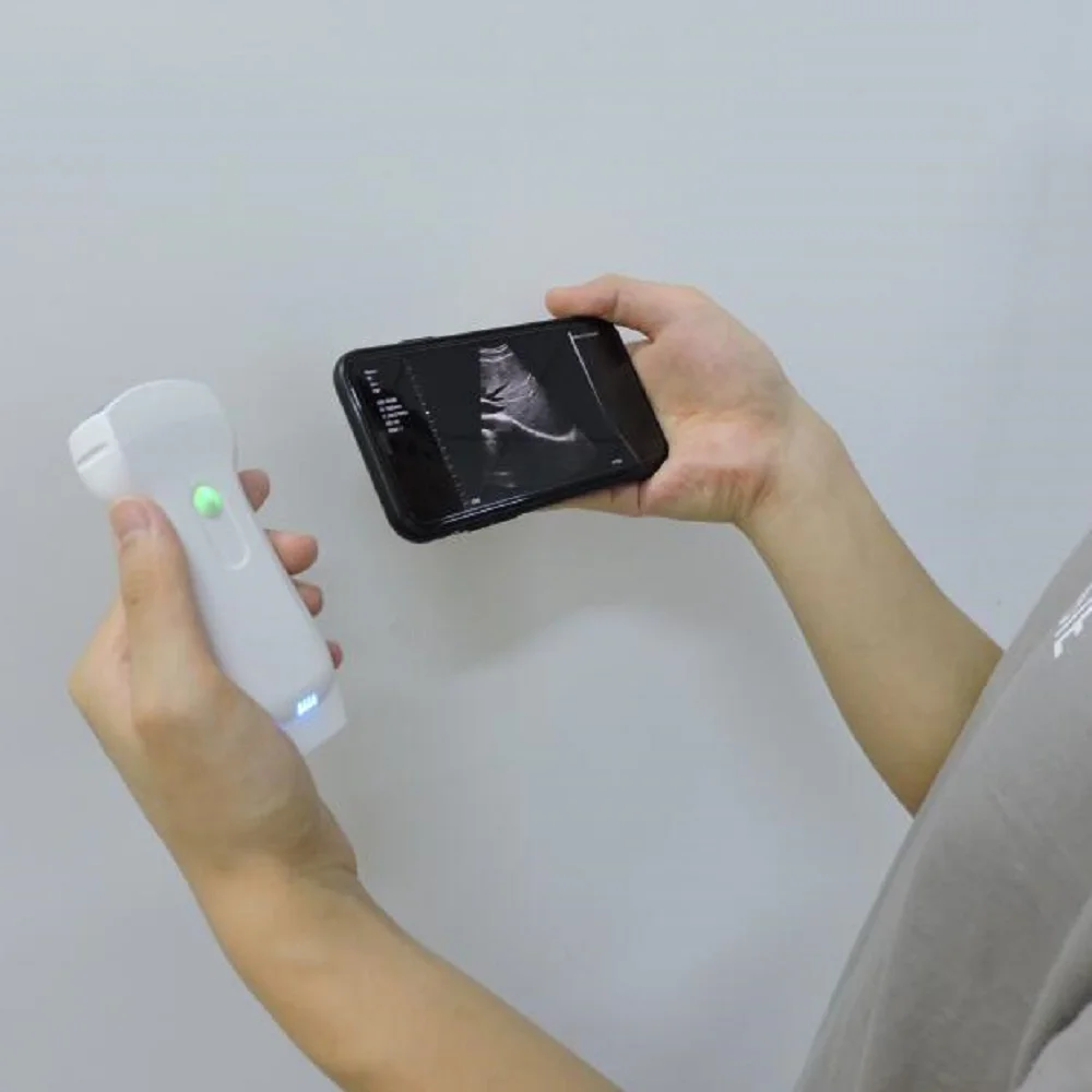 Wireless Ultrasound Probe for Android IOS Apple Google Play Windows Systems 3-in-1 Double Heads 128 Elements Color Doppler Probe