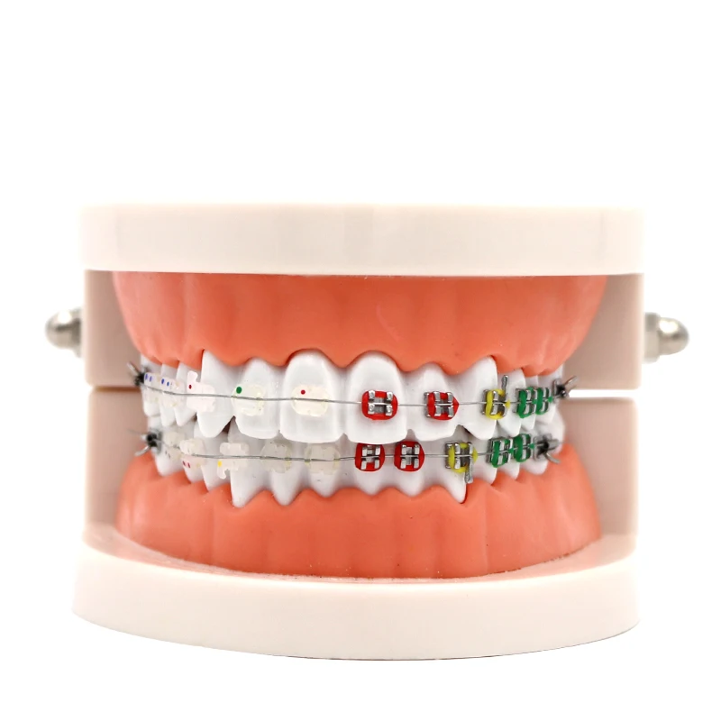 Dental Orthodontic Treatment Model Typodont With Ortho Metal Ceramic Bracket Arch Wire Orthodontic Toothed Denture Model