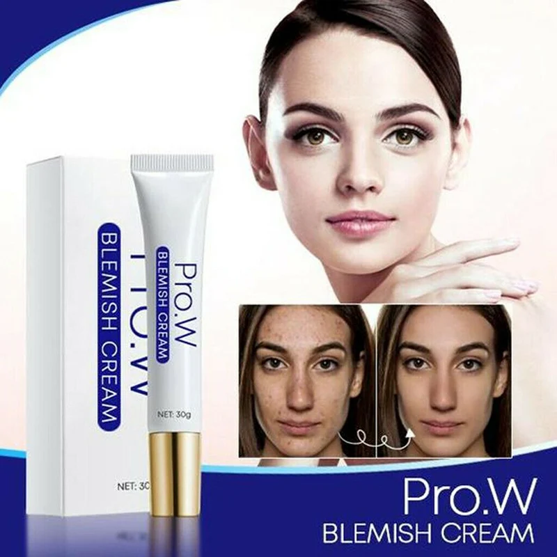 High Quality Pro.W Blemish Cream Freckles Acne Pimple Scar Dark Spots Removal Skin Whitening Brightening