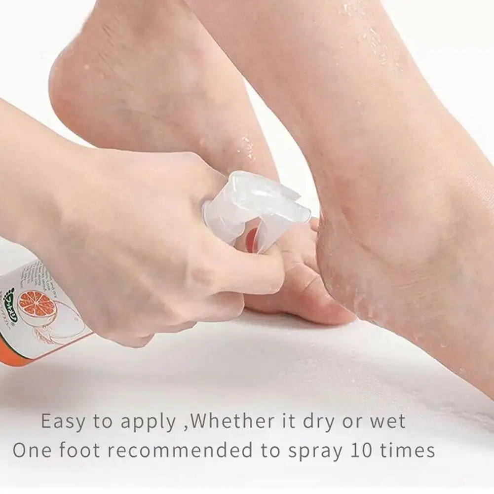 30 / 100ML Foot Exfoliating Spray Foot Peeling Dead Skin Remove Spray Natural Orange Essence Pedicure Hand Callus Whitening Care