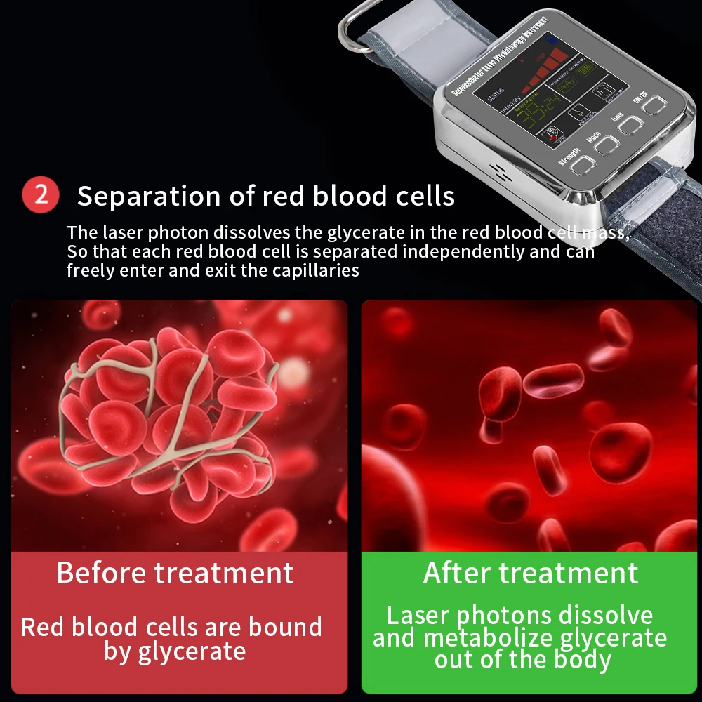 12/7 fori orologio per terapia Laser LLLT orologio da polso 650nm per diabete colesterolo ipertensione trattamento Laser sinusite terapia