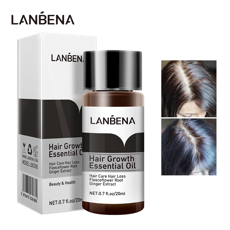 LANBENA Fast Powerful Hair Growth Essence Products Essential Oil Treatment Preventing Hair Loss Hair Care Andrea 20ml