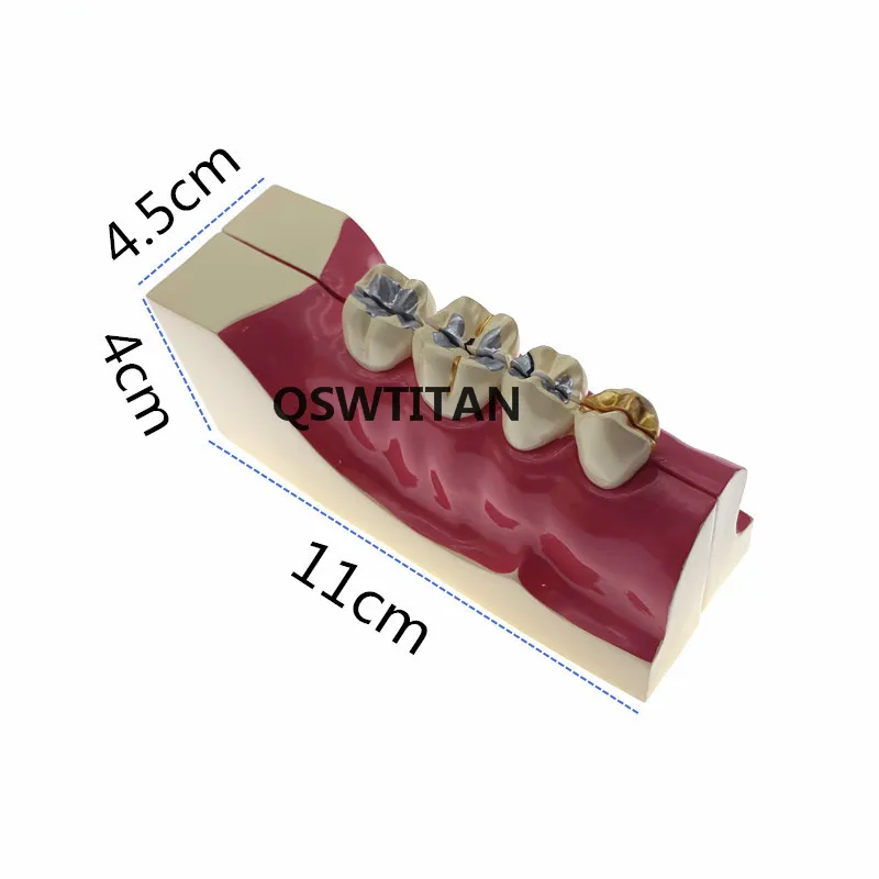 Zęby anatomii Model molowy przekrój rozkładu model w prawym dolnym rogu tylnej model zębów