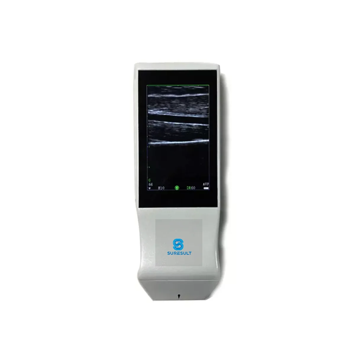 Suresult Portable Touch Screen Ultrasound Scanner Color Doppler Vascular Linear Probe