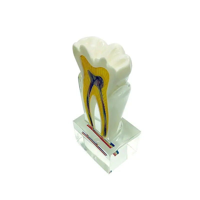 

Dentistry Product 6 Times Tooth Model with Nerves Dental Teeth Model Teaching Model