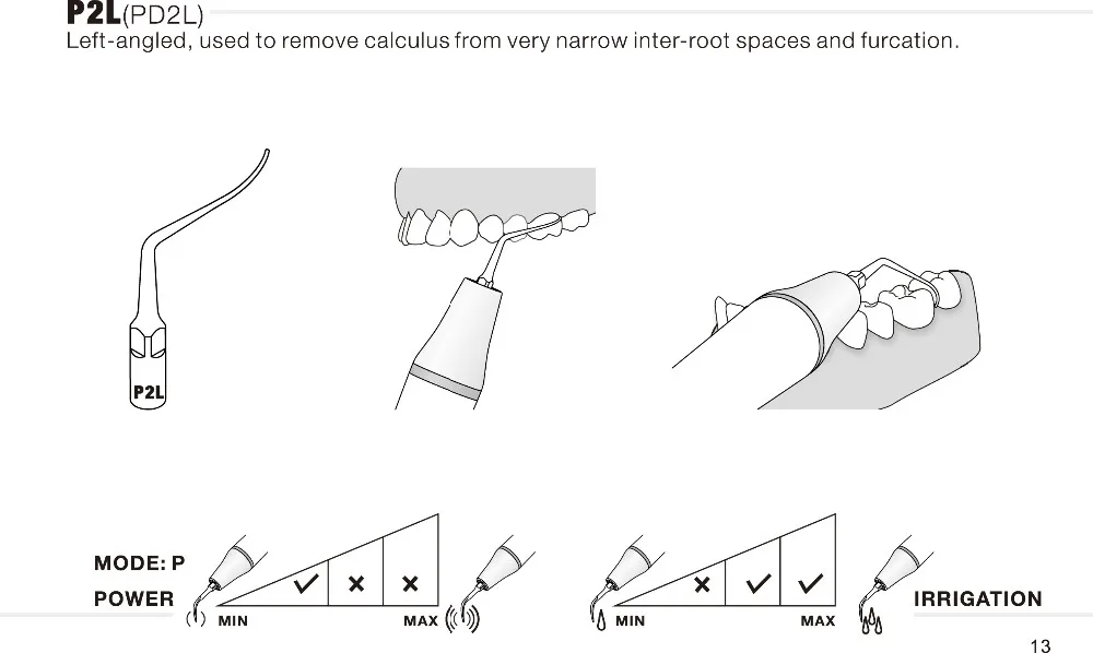 2Pcs PD2L ทันตกรรม Scaling Perio เคล็ดลับสำหรับ Satelec DTE NSK Ultrasonic Scaler Handpiece เคล็ดลับฟันไวท์เทนนิ่ง