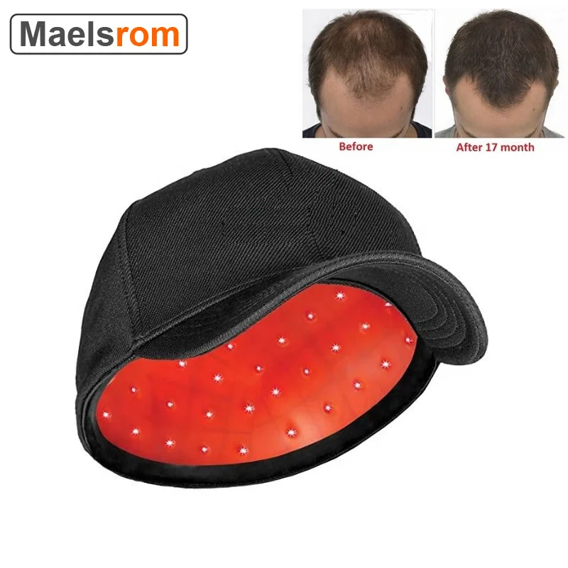 650nm Laser Therapy Hair Growth Helmet Anti Hair Loss Device Anti Hair Loss Promote Hair Regrowth Cap 81 pcs Laser