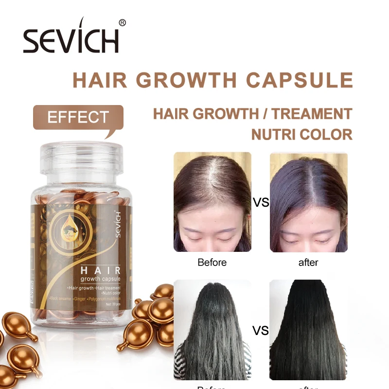 Sevich Hair Vitamin Capsule Ginger Keratin Complex Oil Smooth Silky Anti Hair Loss Repair White Hair Care Capsule 30pcs/bottle