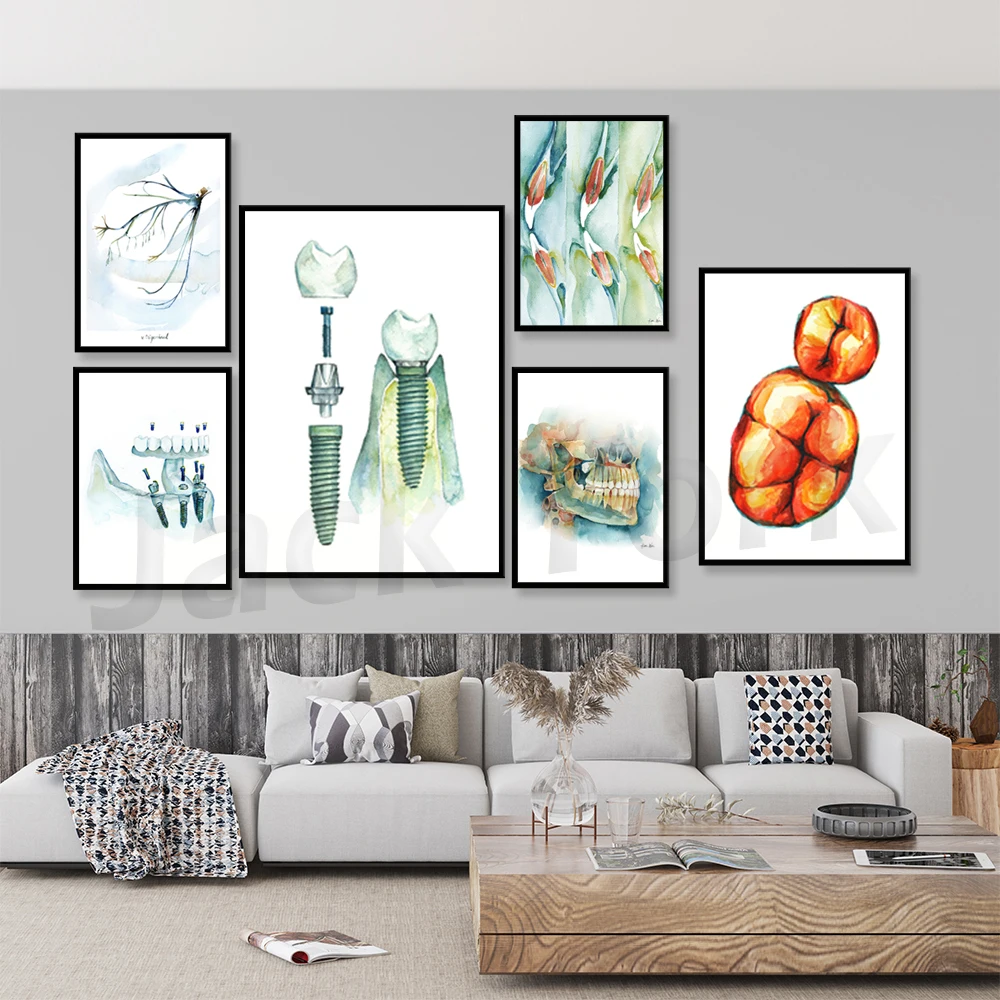 Dental Implant Watercolor Art Print - Dental Anatomy Art - Dental and OMFS Anatomy