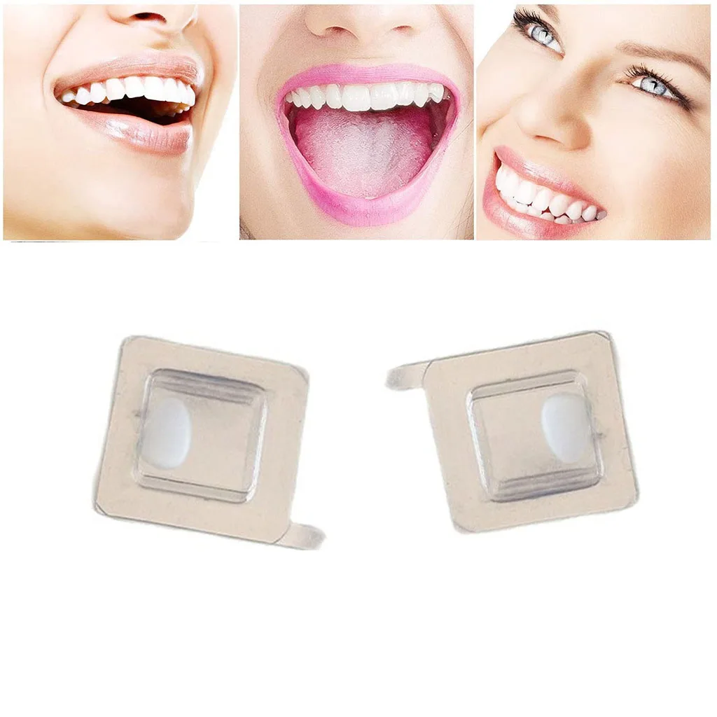 1 Pcs Dental Composite Porcelain Veneers Upper Lower Ultra Thin Whitening Crown Teeth Anterior Dentistry Restoration Materials