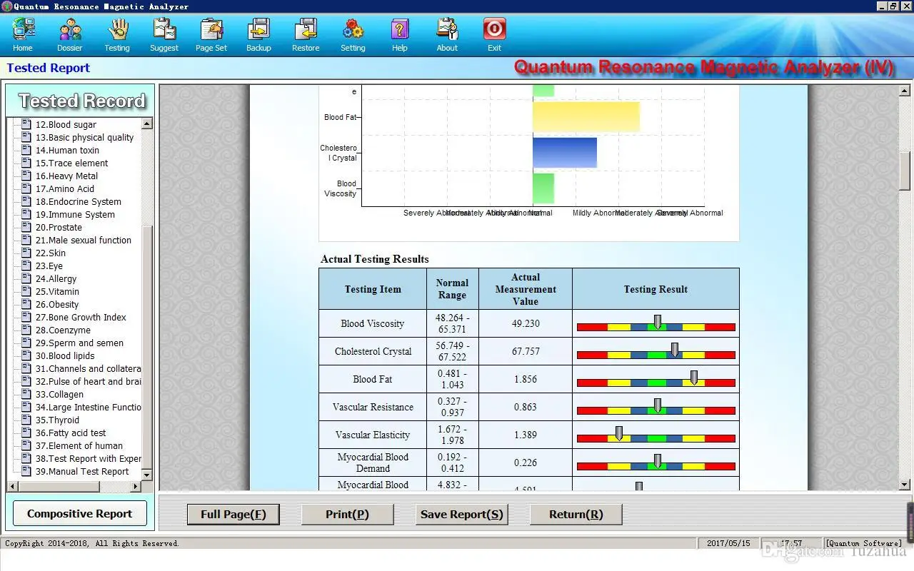 62 Reports Bioscan Quantum Analyzer Machine Magnetic Resonance Full Body Analysis Resonant Health Device with Hand Senser