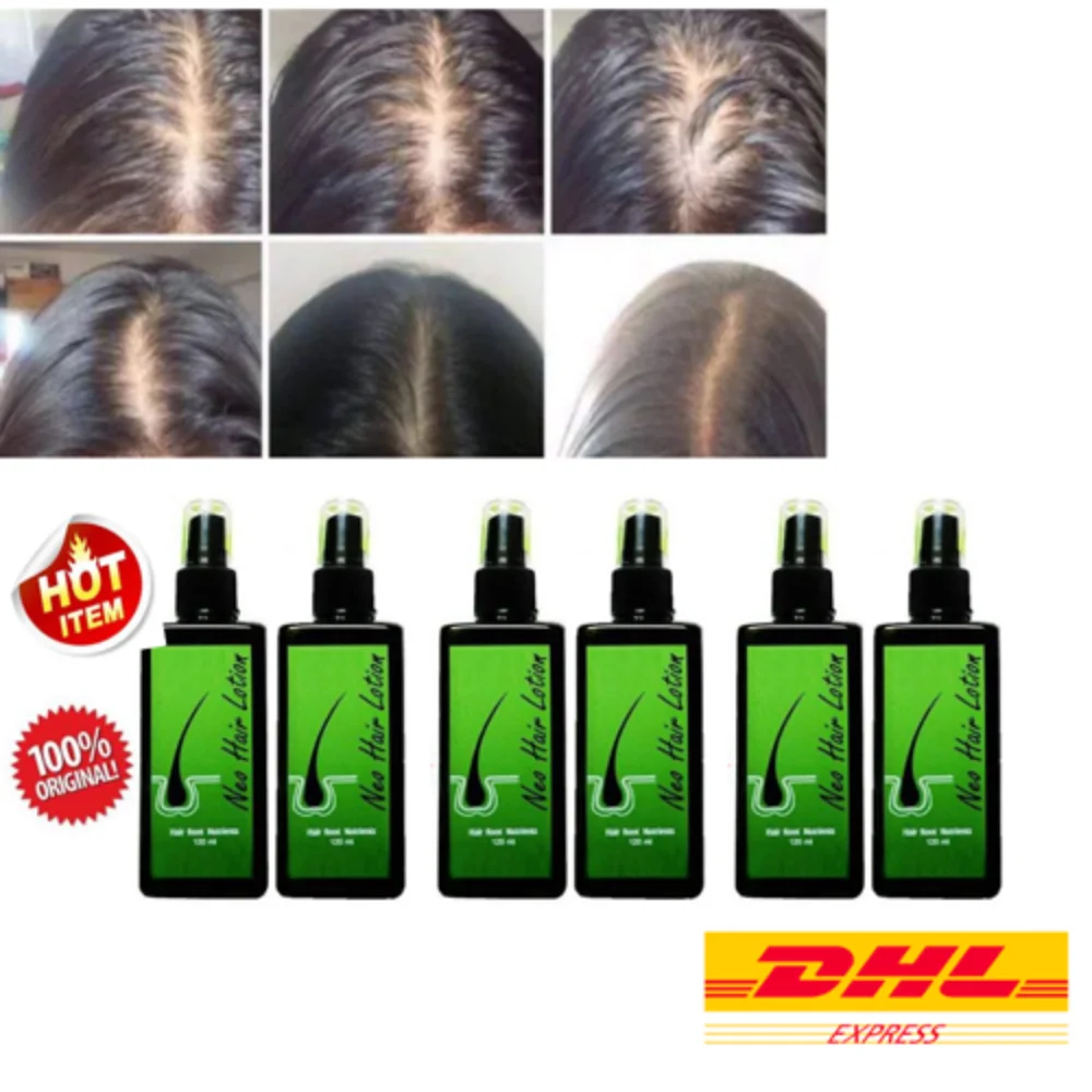 6pcs Original 120ml Neo Hair Lotion Hair Root HAIR BEARD SIDEBURNS LONGER Herbs Treatment 100% Original Thailand Free