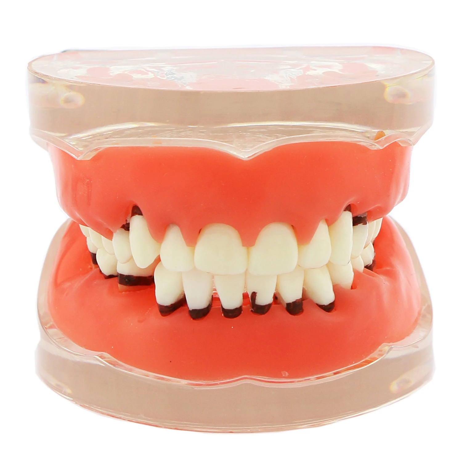 

Dental Teeth Model Periodontal Disease Gingivas Recession Adult Pathological