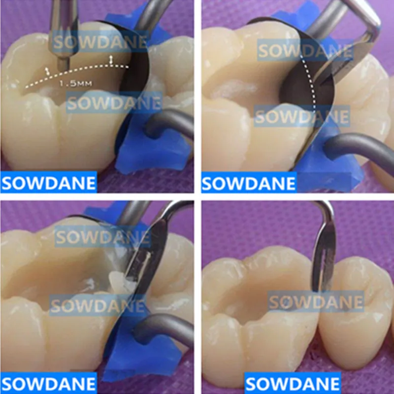 Dental Composite żywica wypełnienie szpachelka zęby dentystyczne estetyczna renowacja trymer żywica wypełniacz narzędzie Dental przywrócenie łopatka