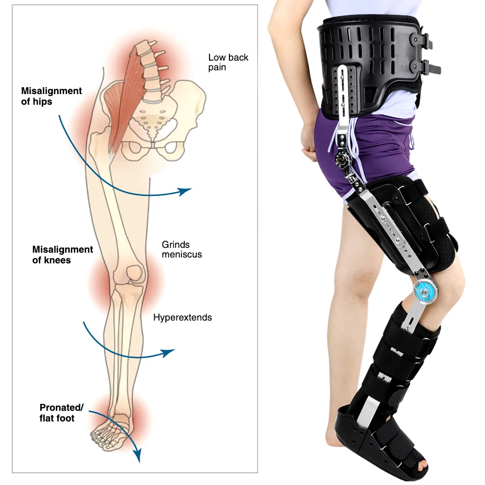 Hip Knee Ankle Foot Orthosis for Hip Fracture Femoral Femur Fracture Hip Instability Fixation of Lower Limb Paralysis Leg