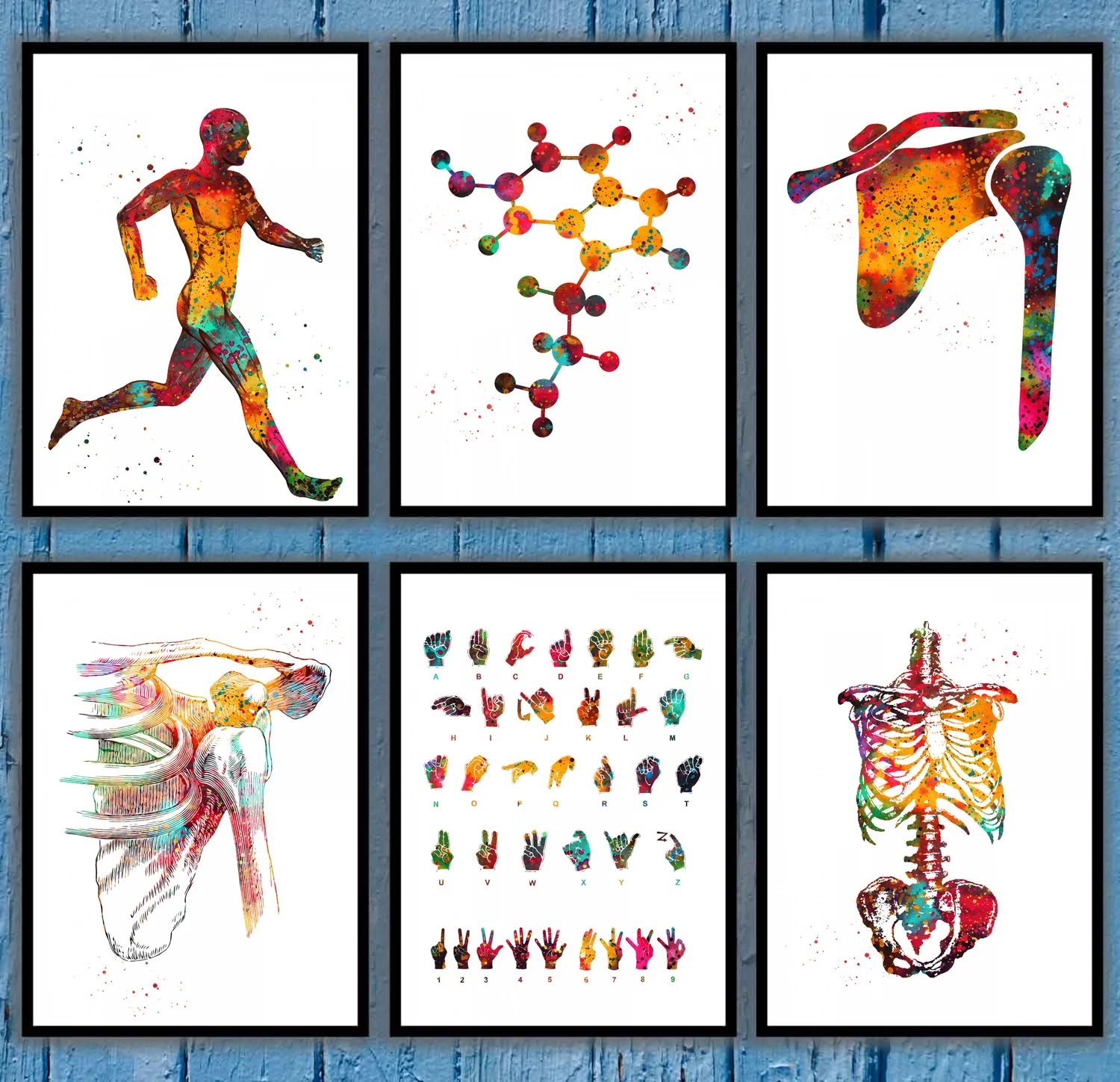 Canvas Painting Posters Molecule Shoulder Dislocation Shoulder Joint Dislocation Sign Language Anatomy Wall Art Home Decor