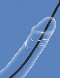 Silicone Urethral Catheter Dilator Sounding Penis Plug Insert Urethra Catheters Adult Sex Toys For Men Gay Urethra Stimulator