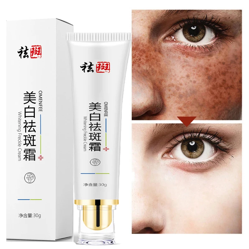 Effective Whitening Freckle Cream Remove Melasma Acne Spot Pigment Melanin Dark Spots Pigmentation Moisturizing Gel Skin Care