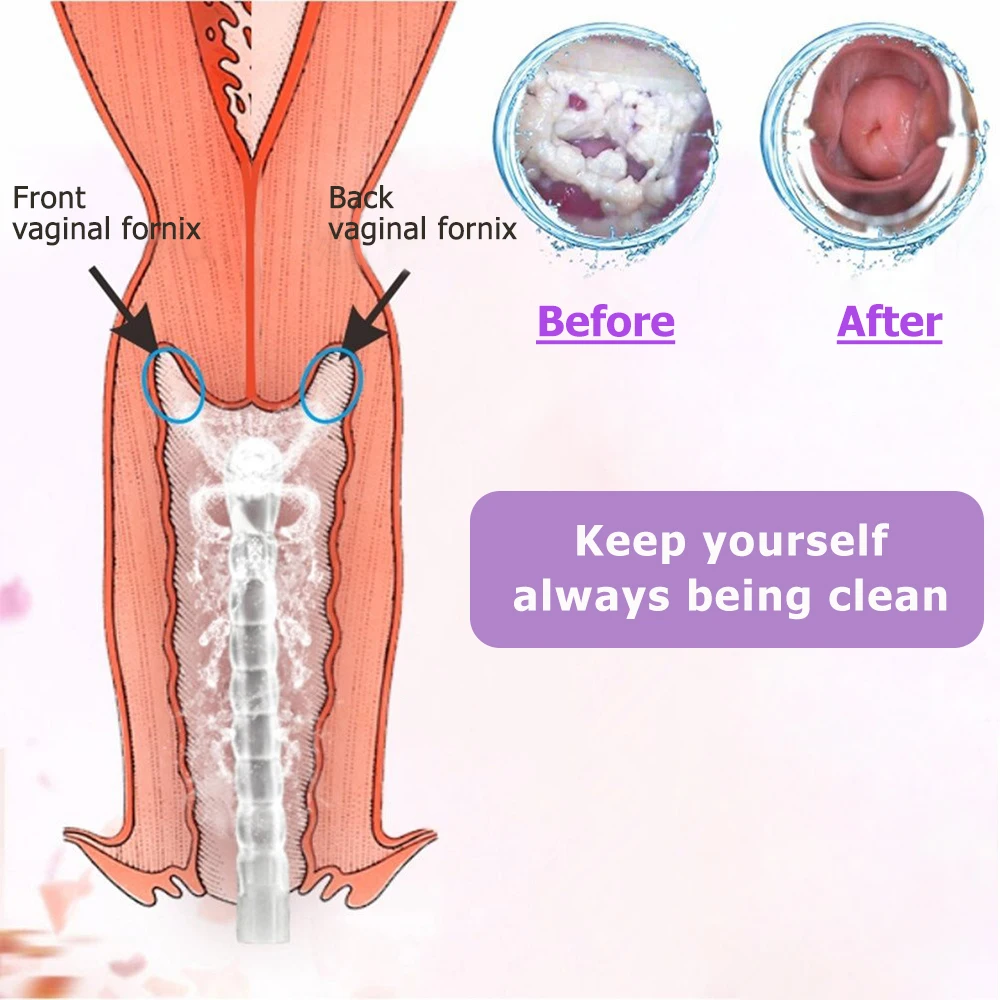 500 مللي/300 مللي المحمولة بيديت أجزاء خاصة جهاز التنظيف رذاذ يده السفر بيديت النساء الحوامل الطفل التطهير غسالة المياه