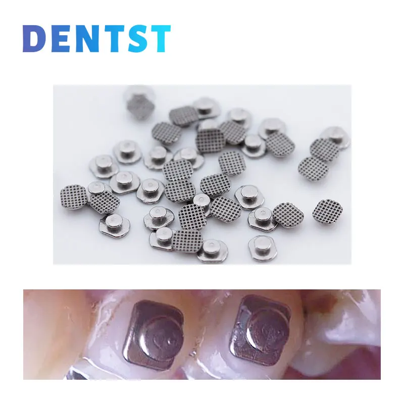 Dentst dental kiefer ortho pä dische linguale knöpfe metall loch punkt mesh rund rect ortodoncia zubehör material 10 teile/beutel