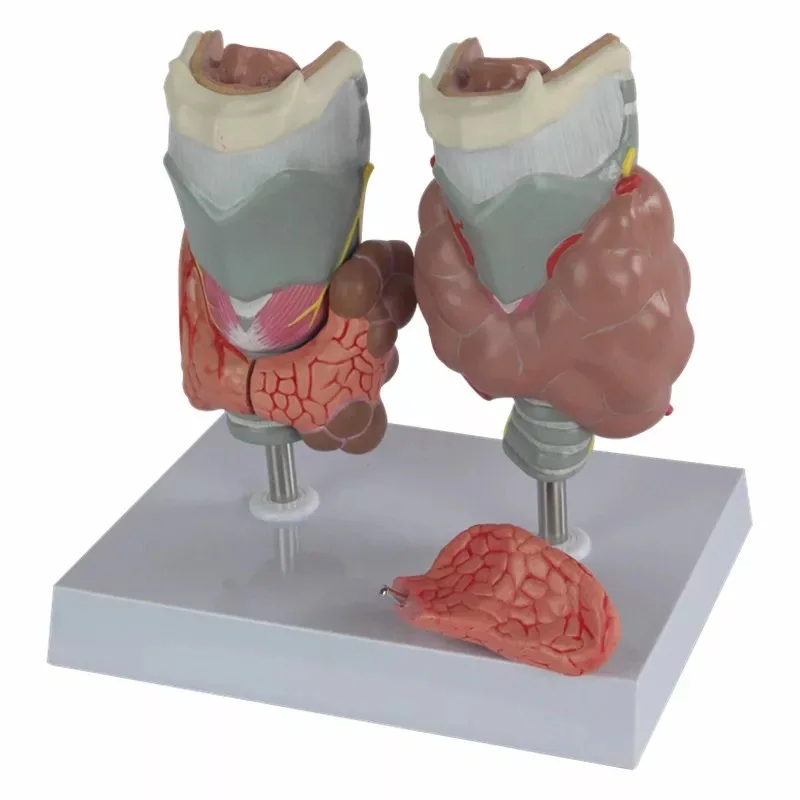 

Thyroid Pathology Medical Anatomical Model of Larynx Hyperthyroidism Hypothyroidism Endocrine System Internal Medicine Specimens