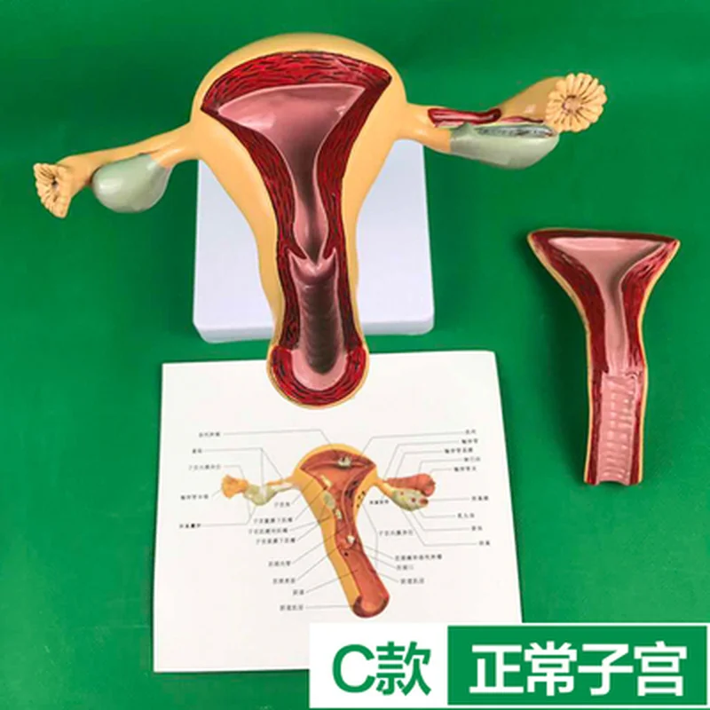 Ovary and uterus disease Dissection model Pathology Female uterus model teaching human medical aids anatomy lesion uterus