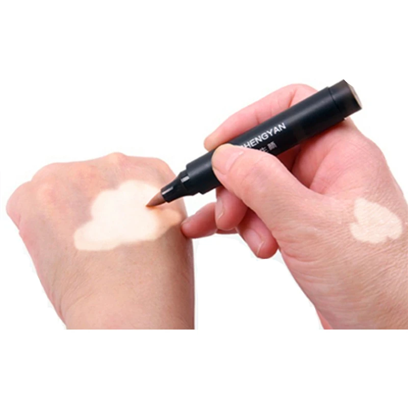 Vitiligo Makeup Waterproof Instant Skin Patches Coating Cover Lotion Conceal Pen on Face Body for Women Men Kids XISHENGYAN 5pc