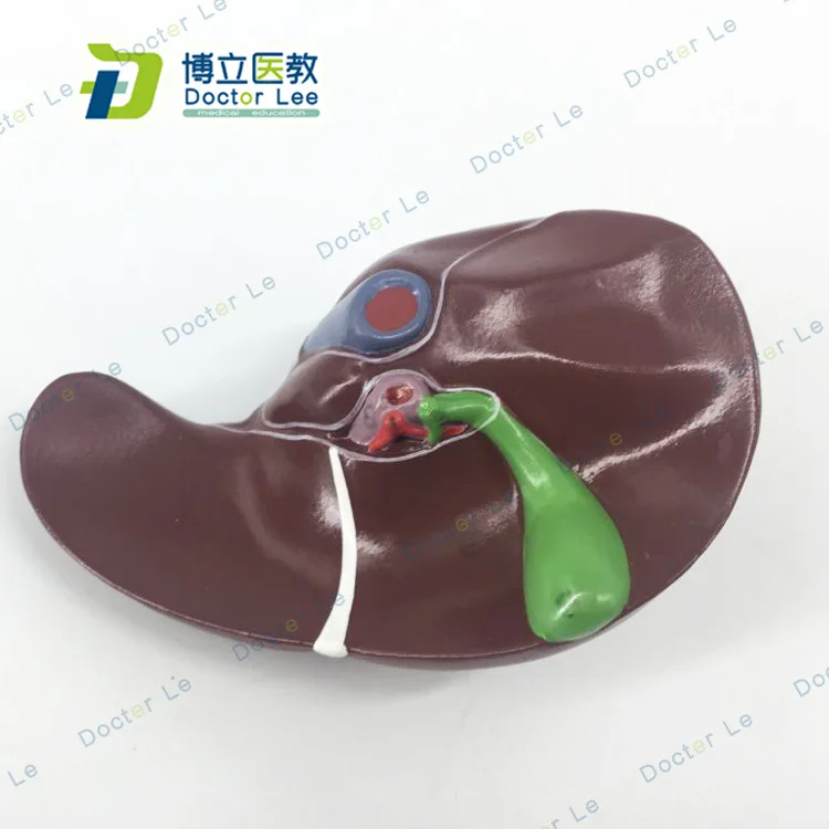 Human Liver Anatomy Model Hepatic Vascular Leaf Hepatobiliary Cystic Duct Model Medical Model