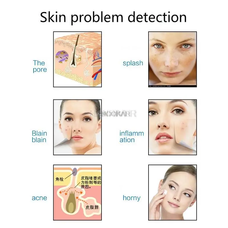 10 Inch Kleur Huid Detector Haar Hoofdhuid Hd Facial Skin Analyzer, Vette, Acne, Water, en Volledig Getest Kappers