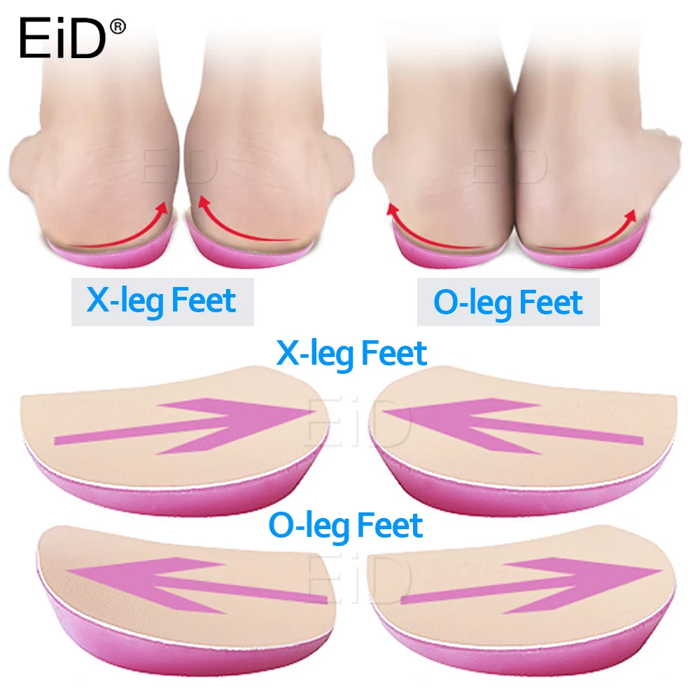 XO Legs Orthopedic shoes Insoles Silicone Gel Arch Support Pad for Women Flat Foot Orthotic Inserts Pain Relief High Heel Pads