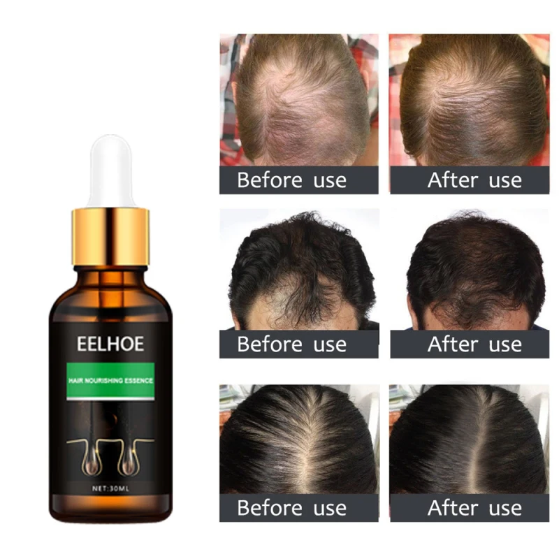 Eelhoe Hair Care Essence Improves Hair Quality, Nourishes Hair, Hair Repairs And Smooths Frizz Hair Care