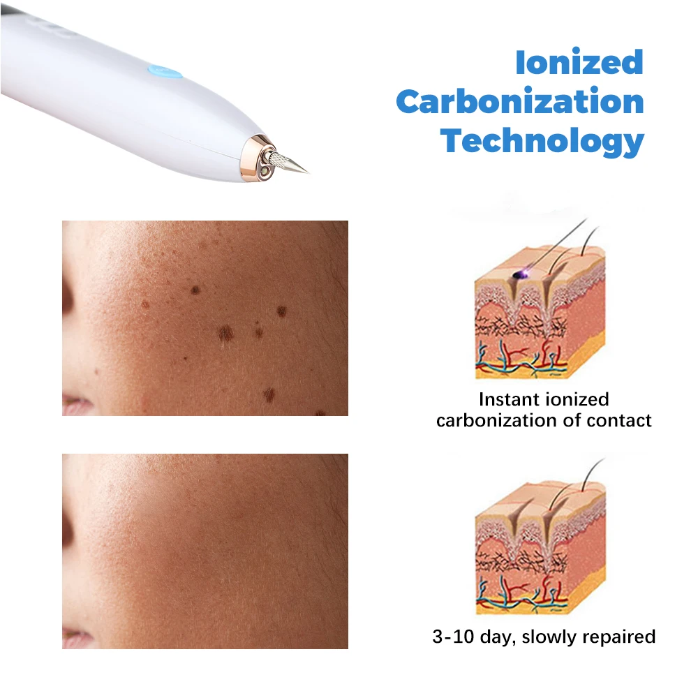 Skin Tag Remover Warts Eliminator Lcd Plasma Pen Papillomas Electric Laser Tattoo Removal Freckle Dark Spot Mole Cauterizer Kit