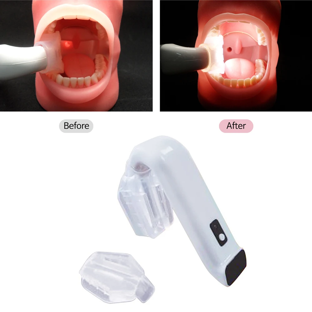 

Стоматологические инструменты, светодиодный Интраоральная система освещения, просвечивается внутрь рта, Портативная USB-зарядка, беспроводное открытие полости рта, стоматология