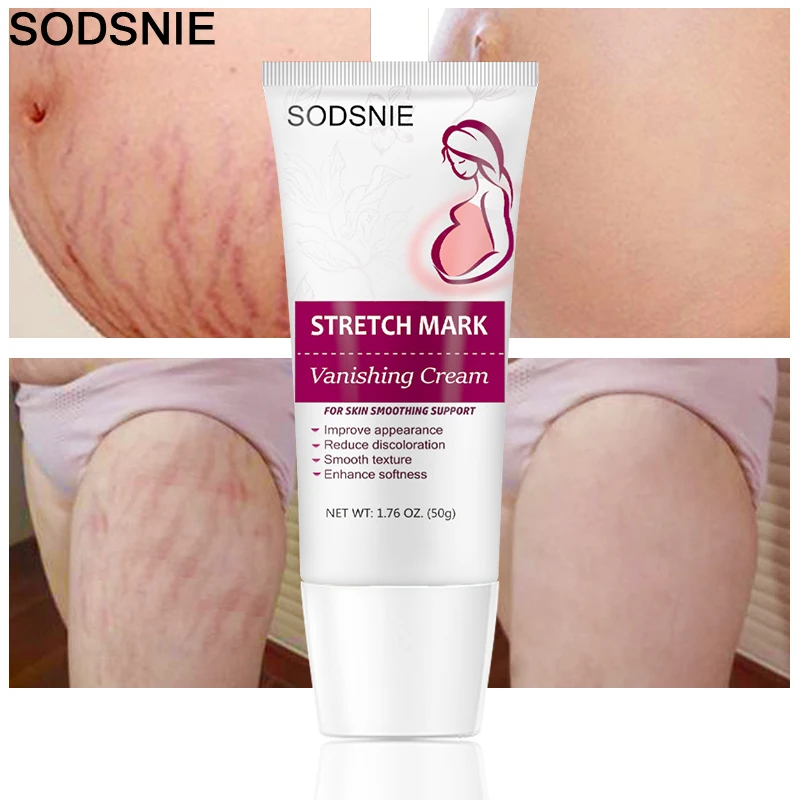 

Stretch Mark Vanishing Cream Repair And Nourish Anti-Wrinkle Anti-Aging Firming Lifting Stretch Mark Treatment Body Care 50g