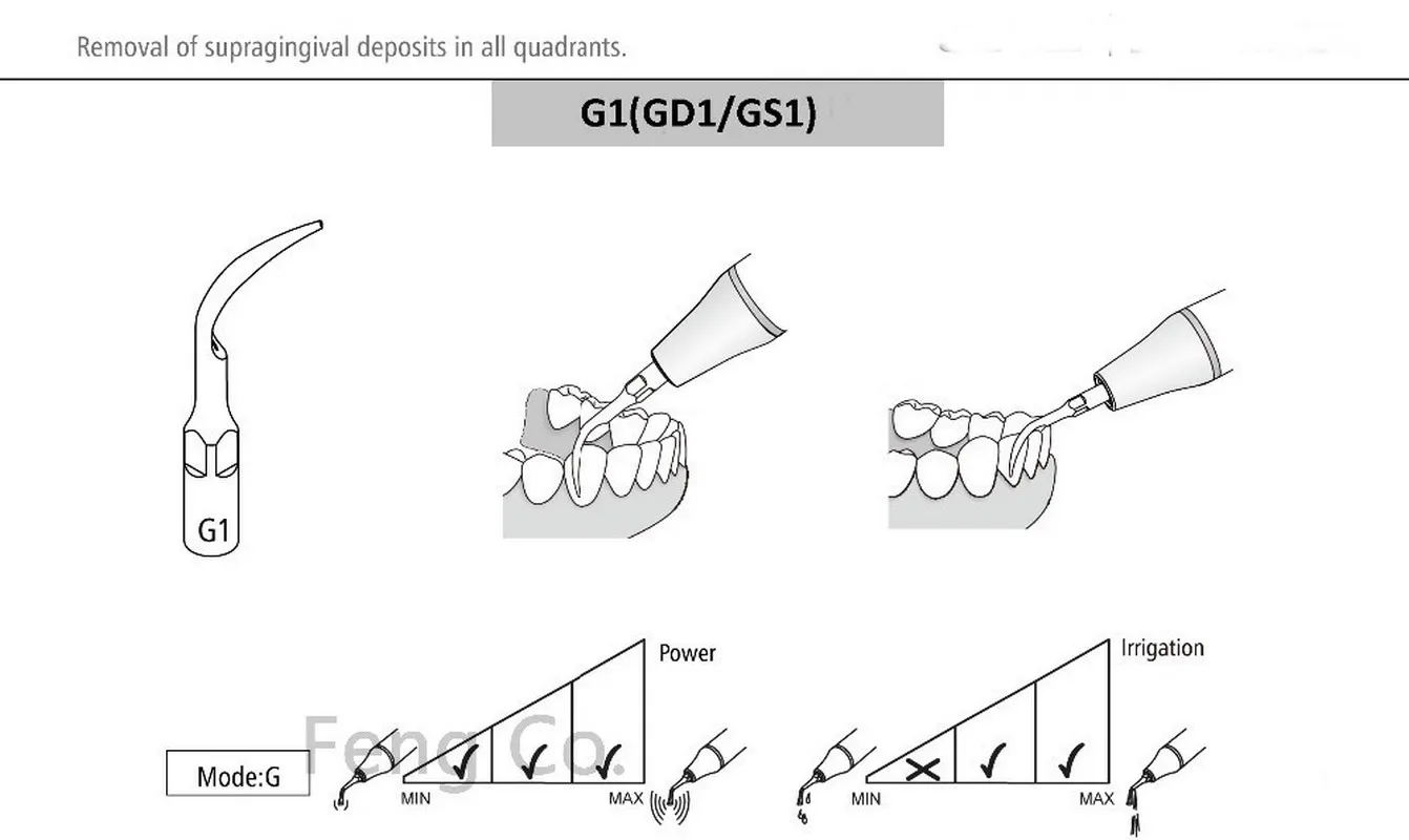 GS1 GS2 GS3 GS4 GS5 GS6 GS7 GS8 Ultrasonic Scaler Tips For SIRONA Handpiece Endo Perio Dental Scaling Dentist Teeth Whitening