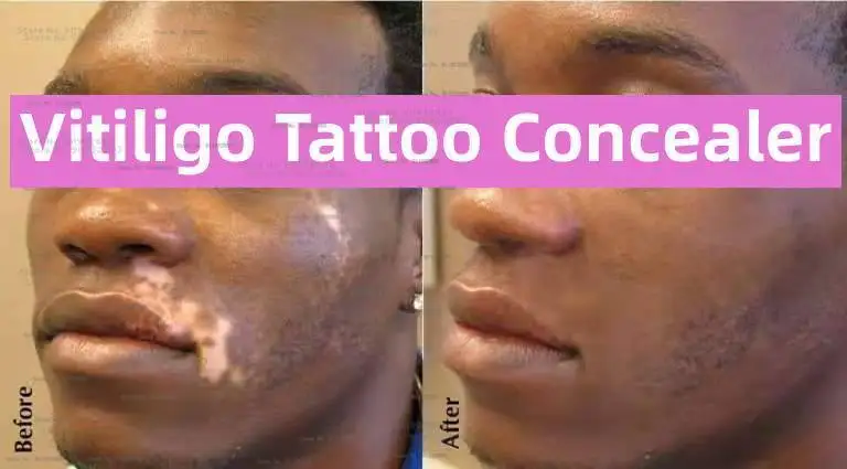 Vitiligo Cover Tattoo Concealer, Concealer To Cover Tattoo/Scar/Birthmarks/Vitiligo, Waterproof