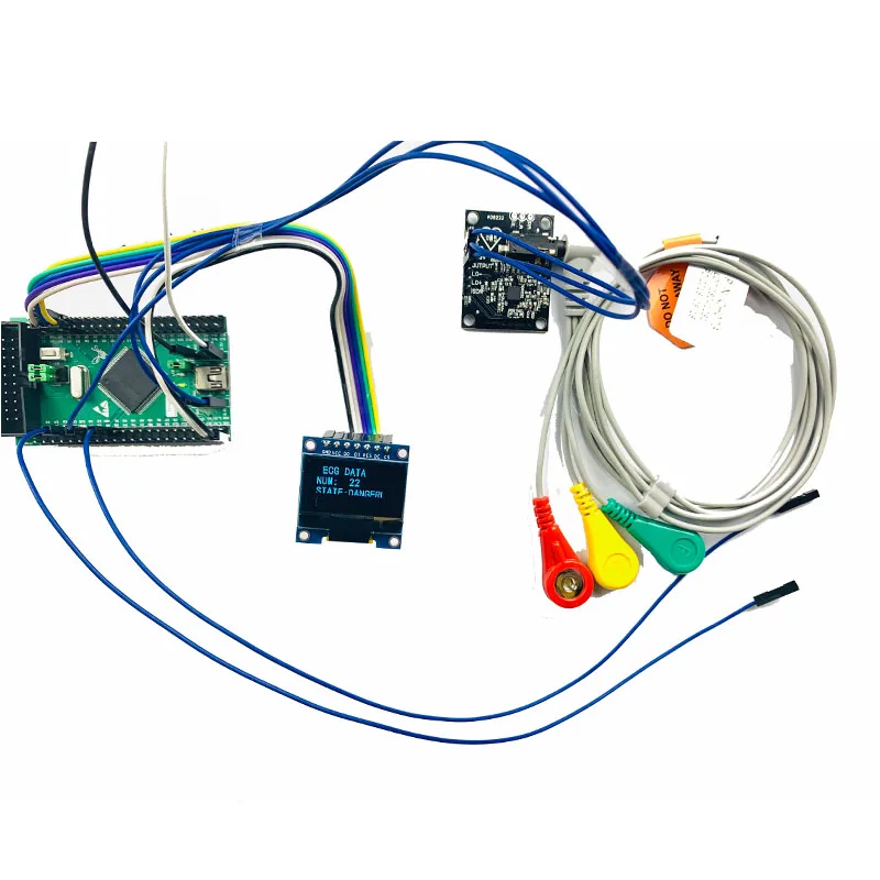 STM32-based AD8232 ECG комплект для сбора сердечного ритма с OLED-дисплеем, портативная и развиваемая система