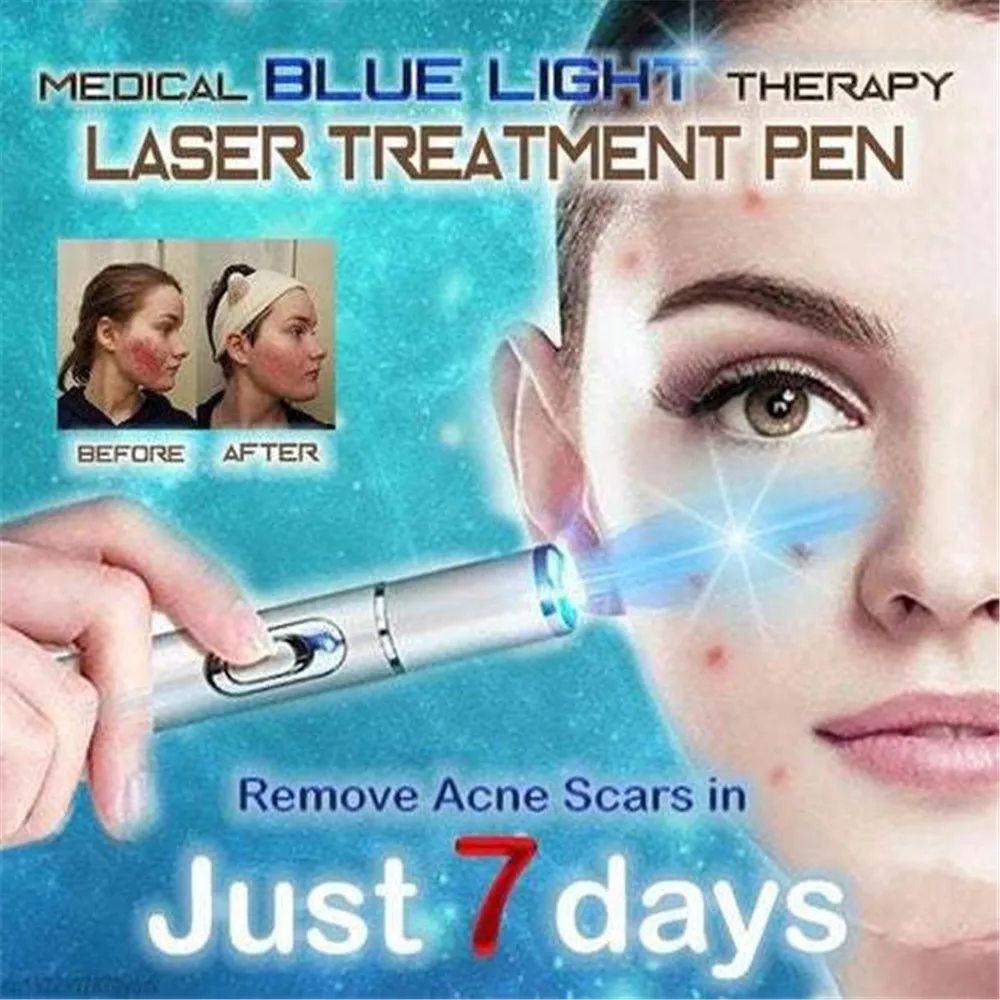 Penna Laser per Acne macchina portatile per la rimozione delle rughe cicatrice morbida rimozione dei cerchi scuri durevole terapia della luce blu