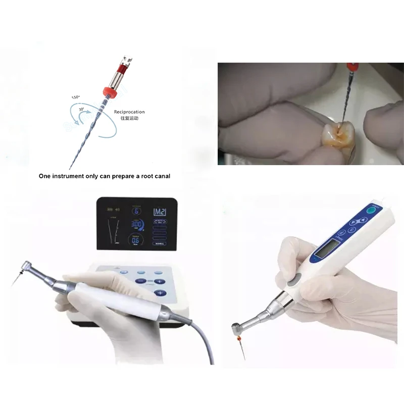Dentale rote Reziprokationsfeilen R25 R40 R50, Reziprokierende Dental-NITI-Feilen, Endodontische NITI-Feilen, Wurzelkanal-Endo-Instrumente – Detail 2