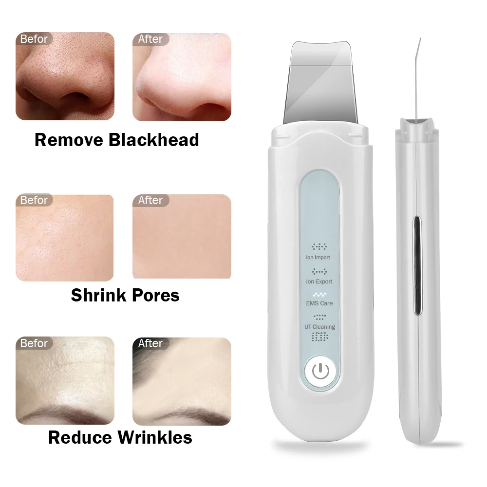 Ultrasone Huid Scrubber Diepe Gezicht Reinigingsmachine Peeling Schop Facial Pore Cleaner Gezicht Huid Scrubber Lift Machine