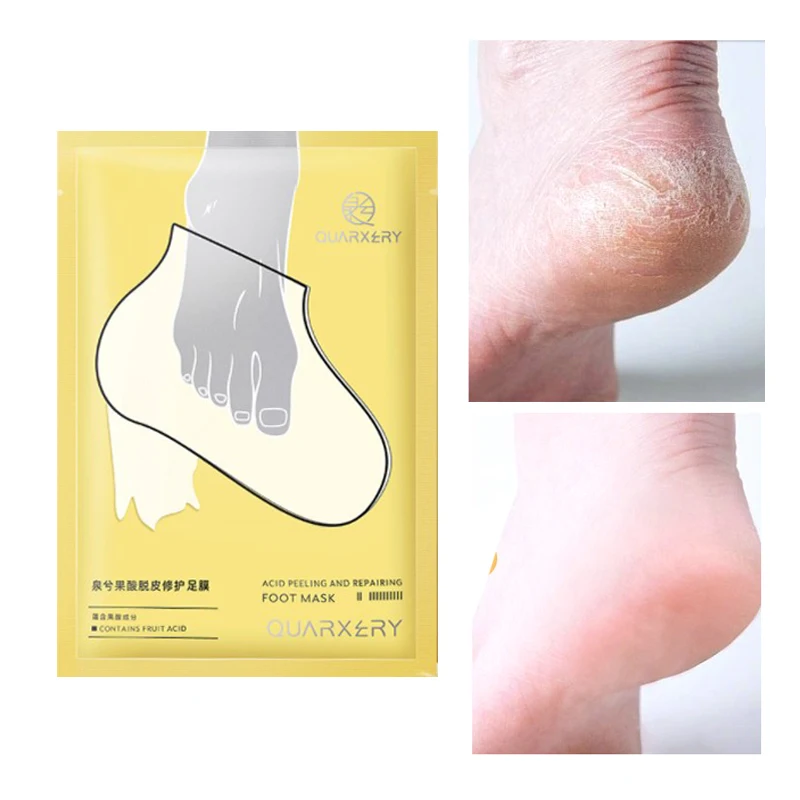 Mascarilla Exfoliante para pies, calcetines exfoliantes para pedicura, en el talón antigrietas, parche para eliminar la piel del pie