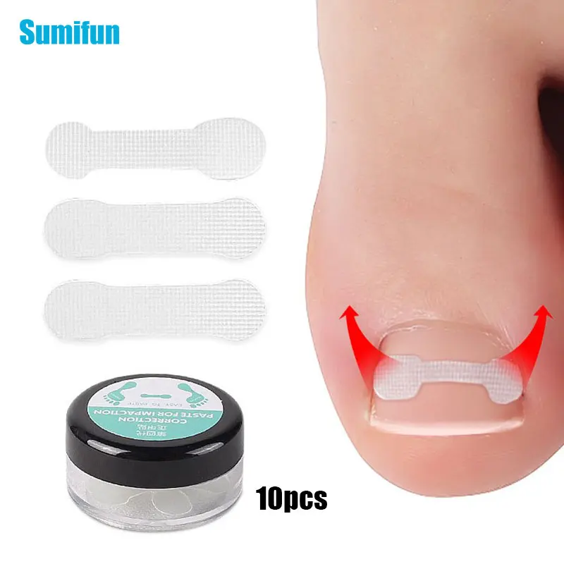 10 sztuk/pudło narzędzie do korekcji wrastających paznokci prostowanie klip Brace wrastający palec u nogi leczenie paznokci elastyczna naszywka naklejka narzędzie do Pedicure