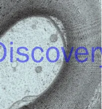 50ถึง400ตาข่ายนำเข้าตาข่ายทองแดงทั่วไปฟิล์มคาร์บอนเกียร์กล้องจุลทรรศน์อิเล็กตรอนตาข่ายฟิล์มสนับสนุน