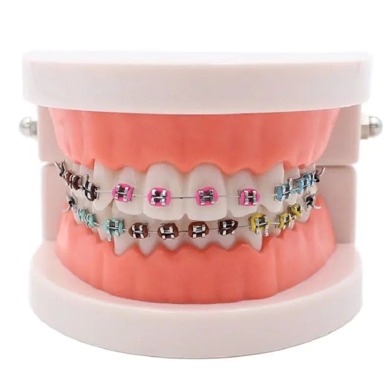 Dental Orthodontic Treatment Model With Ortho Metal Ceramic Bracket Arch Wire Buccal Tube Ligature Ties Dentist Tools Lab